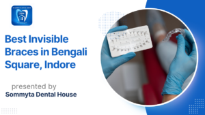 Best Invisible Braces in Bengali Square Indore | Affordable & Advanced Care (2026)