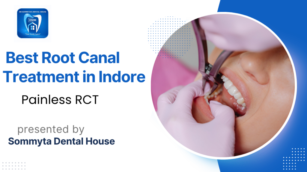 Best Root Canal Treatment in Indore