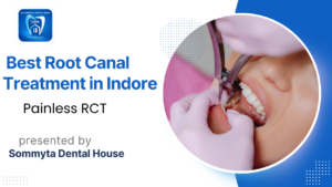 Best & Painless Root Canal Treatment Near Me in Indore (2026 Guide)