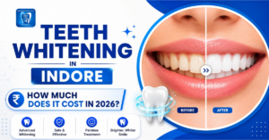 Teeth Whitening in Bengali Square Indore | How Much Does It Cost in 2026?