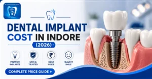Dental Implant Cost in Indore (2026)